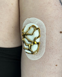 Venom — Dexcom G6 / One